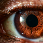 3.MyEye11-1